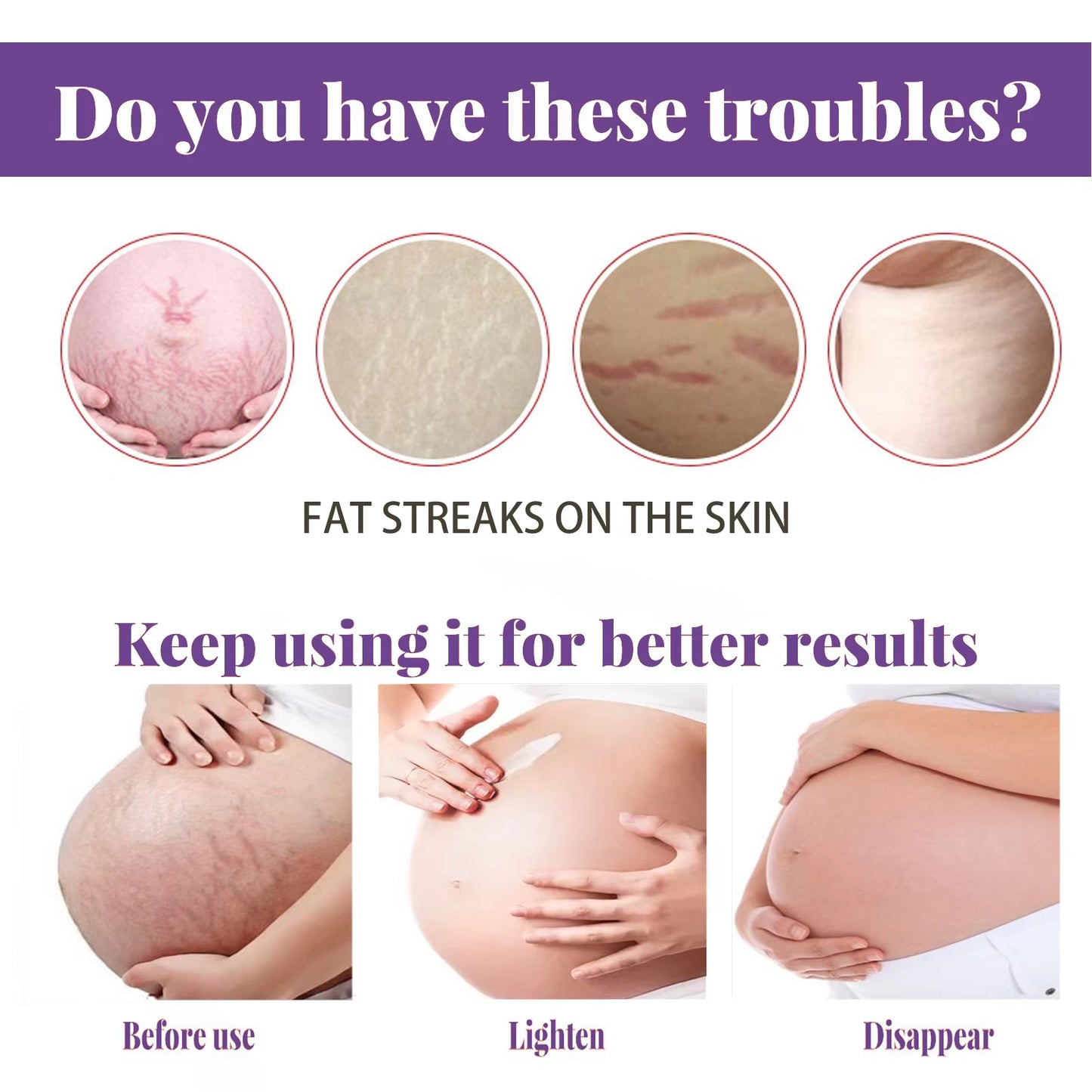 Scar Repair Cream anti Wrinkle anti Aging Maternity Skin Repair Remove Pregnancy Surgical Scars Treatment Body Skin Care Cream