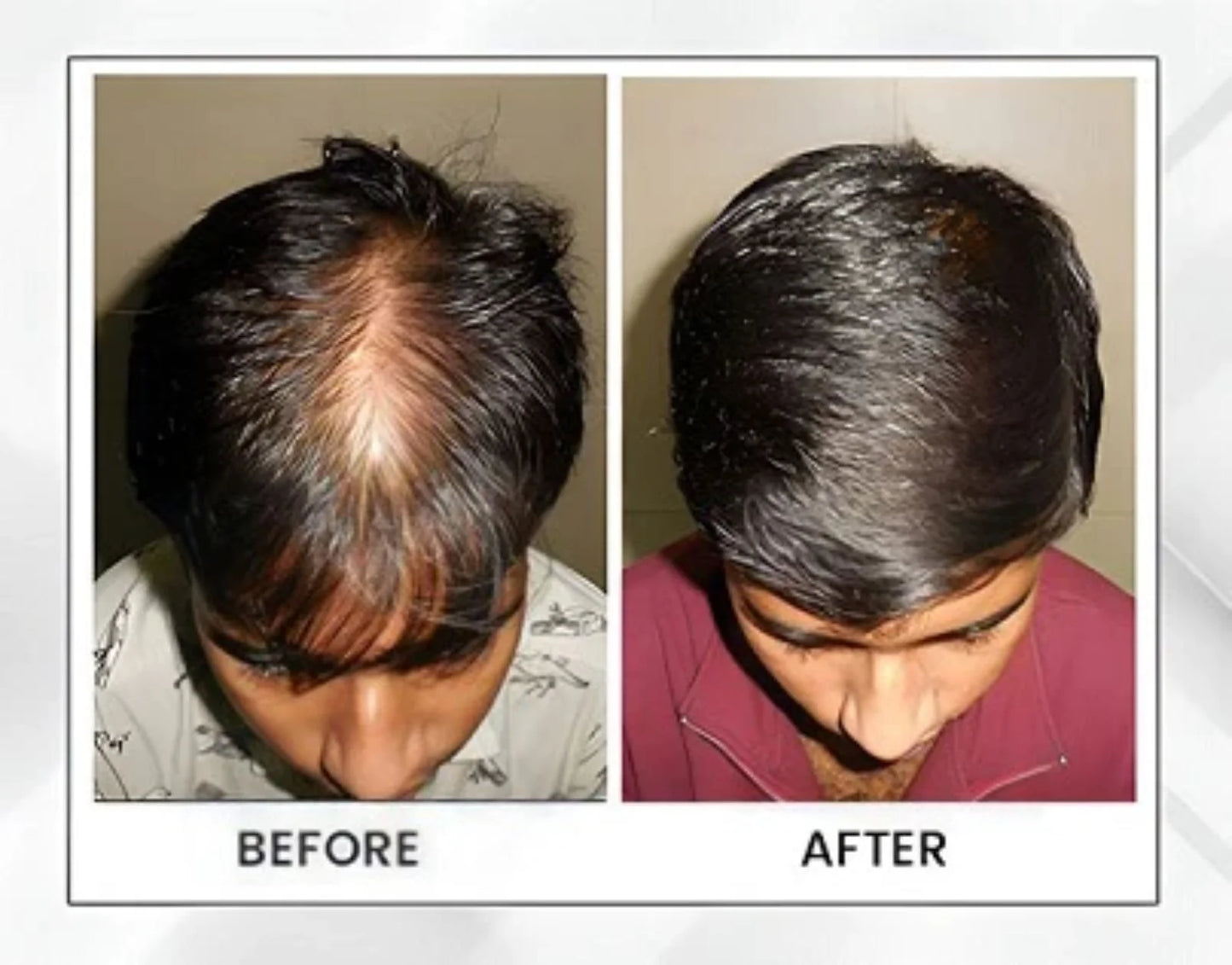 DHT Blocker, Hair Regrowth System, Hair Loss & Regrowth Supplements for Men and Women