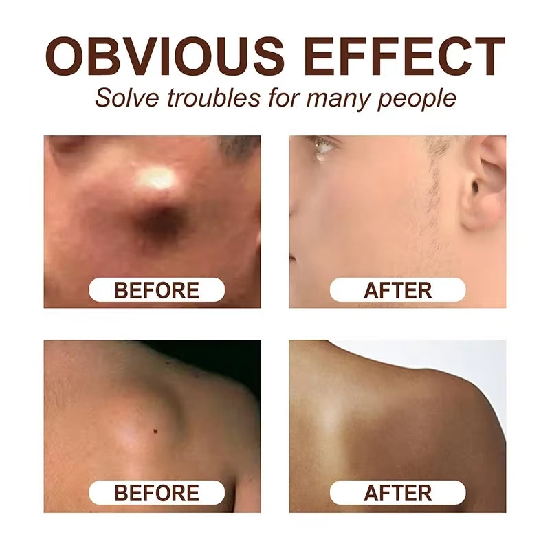 Subcutaneous Lump Removal Soothing Cream Is Suitable for Eliminating Fat Lumps and Reducing Fat Lumps It Is a Body Health Cream