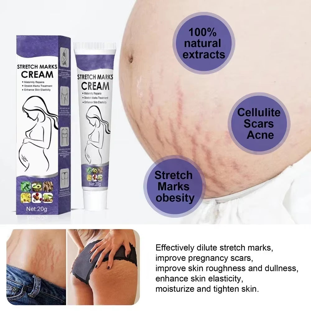 Scar Repair Cream anti Wrinkle anti Aging Maternity Skin Repair Remove Pregnancy Surgical Scars Treatment Body Skin Care Cream