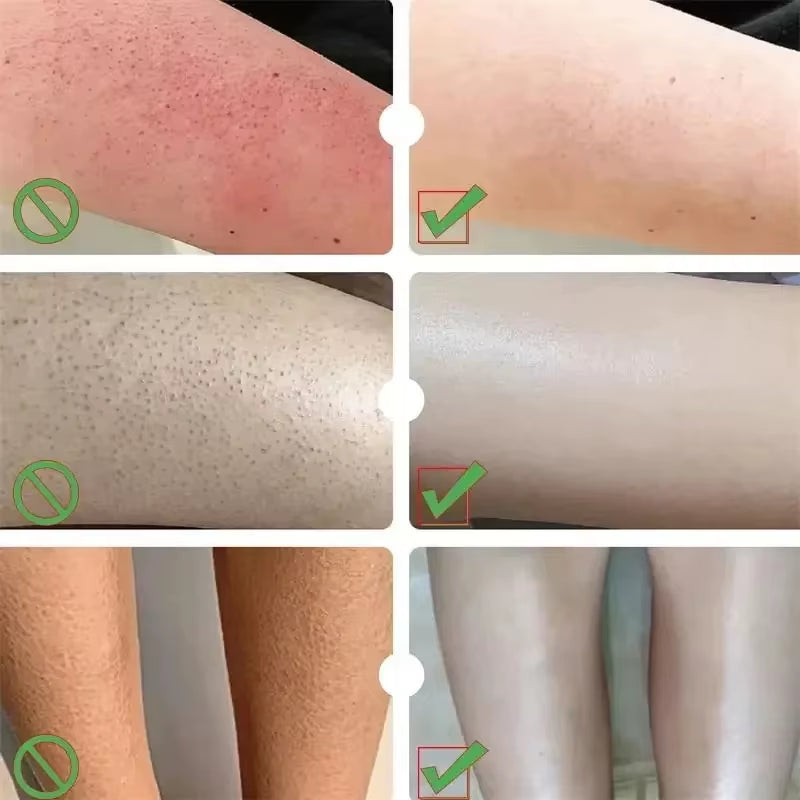 Herbal anti Crack Foot Cream Heel Cracking Repair Products Exfoliation Dead Skin Removal Softening Moisturize Smooth Skin Care