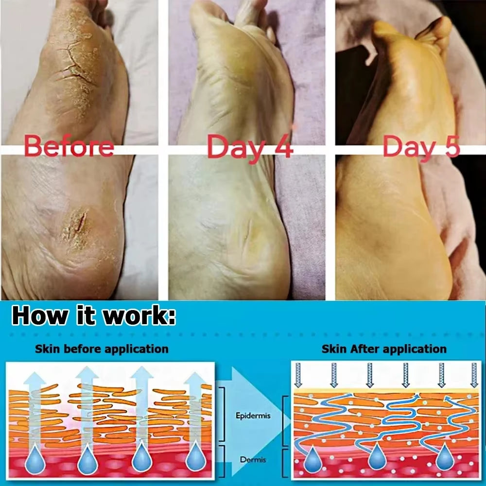 Herbal anti Crack Foot Cream Heel Cracking Repair Products Exfoliation Dead Skin Removal Softening Moisturize Smooth Skin Care