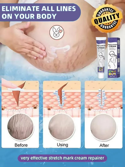 Scar Repair Cream anti Wrinkle anti Aging Maternity Skin Repair Remove Pregnancy Surgical Scars Treatment Body Skin Care Cream
