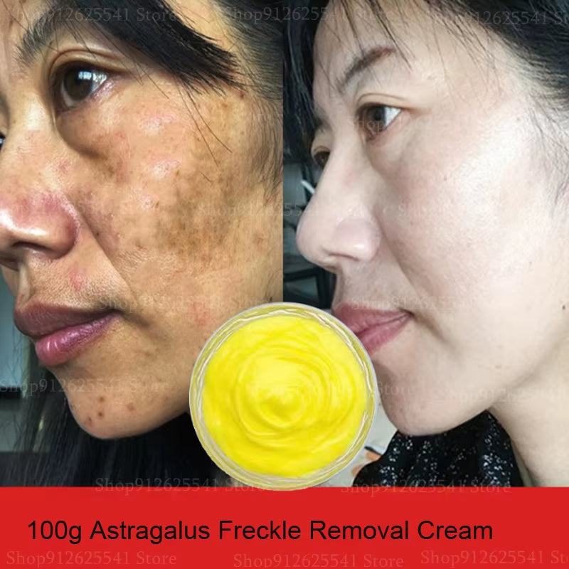 Herbal Astragalus Face Cream Moisturizing Whitening Night Cream Freckle Removal Cream Quick Spot Remover Facial Treatment Gel