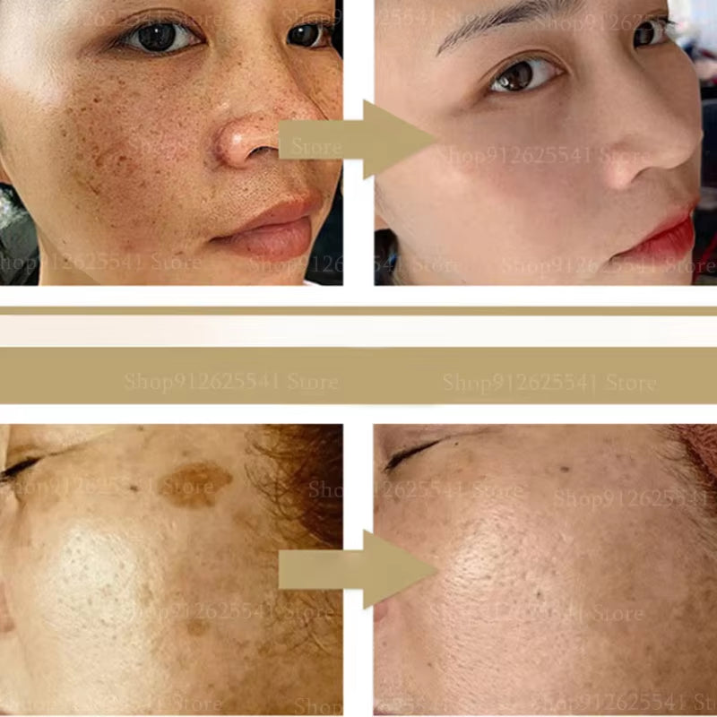 Herbal Astragalus Face Cream Moisturizing Whitening Night Cream Freckle Removal Cream Quick Spot Remover Facial Treatment Gel
