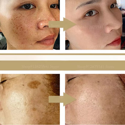 Herbal Astragalus Face Cream Moisturizing Whitening Night Cream Freckle Removal Cream Quick Spot Remover Facial Treatment Gel