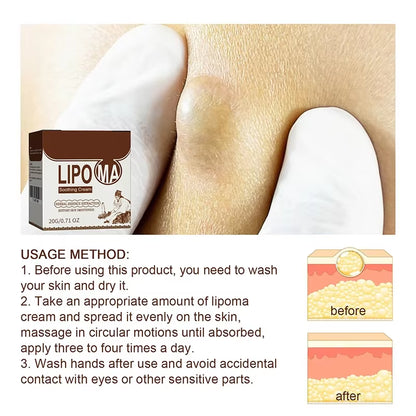 Subcutaneous Lump Removal Soothing Cream Is Suitable for Eliminating Fat Lumps and Reducing Fat Lumps It Is a Body Health Cream