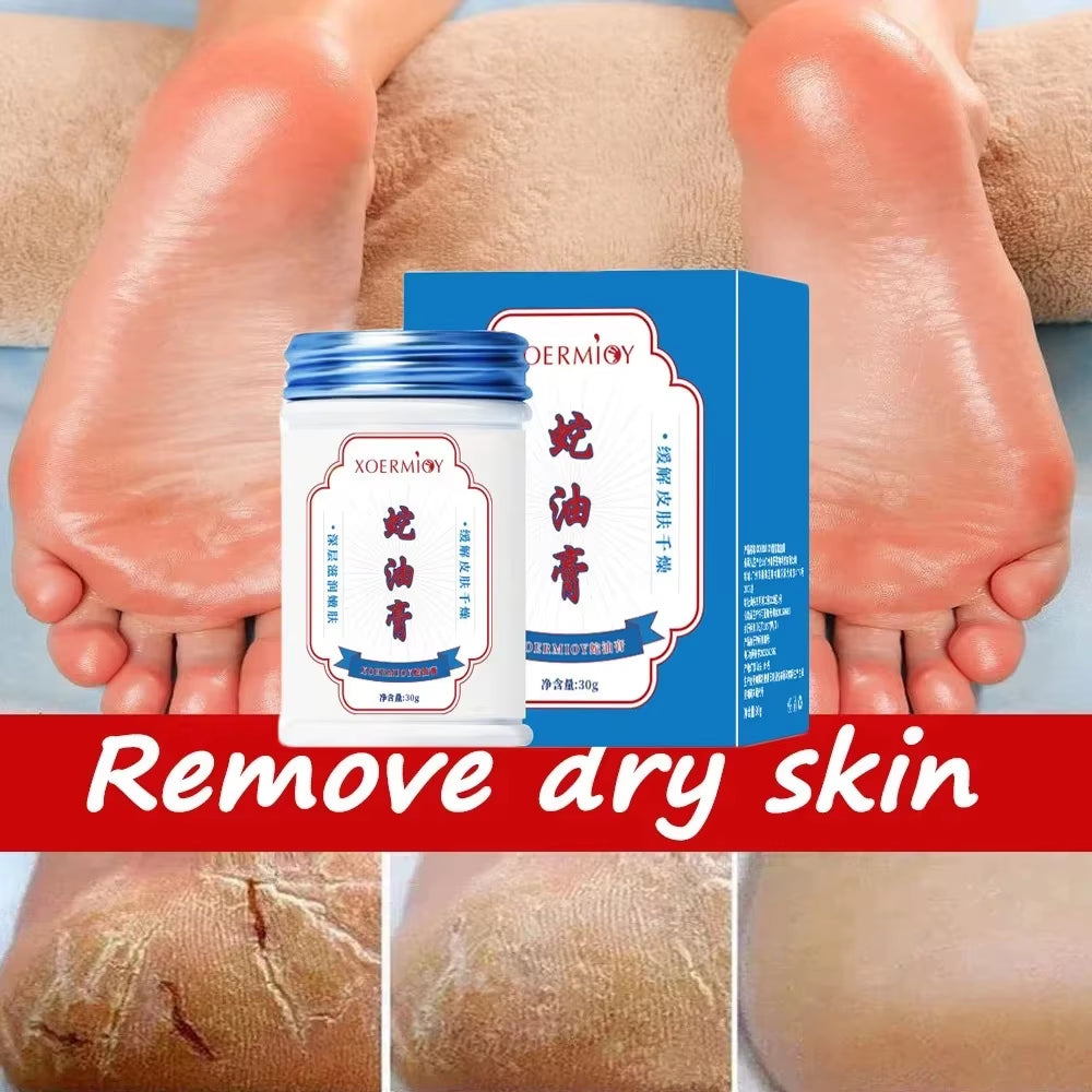 Herbal anti Crack Foot Cream Heel Cracking Repair Products Exfoliation Dead Skin Removal Softening Moisturize Smooth Skin Care